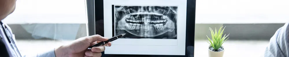 X-Ray License