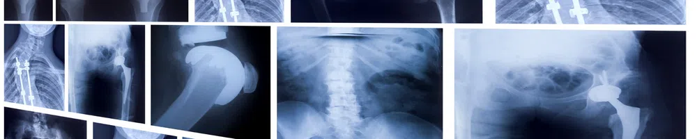 X-Rays 