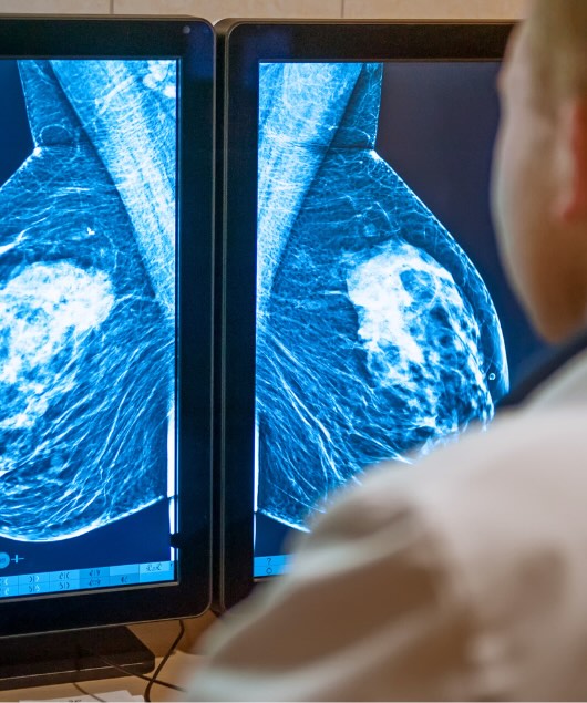 How DBT, CEM, & Emerging Technologies Are Reshaping Mammography Radiation Safety